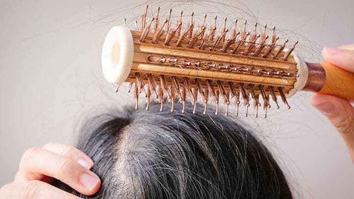 The Relation Between Menopause and Hair Loss (1)